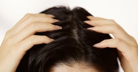 두피염의 증상과 원인, 치료법이 주목된다. 사진은 기사 내용과는 무관함. /사진=클립아트코리아