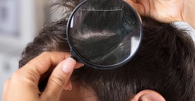 비듬 제거법이 주목된다. 사진은 기사 내용과는 무관함. /사진=클립아트코리아