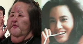 '선풍기 아줌마' 한혜경, 얼굴 이물질만 4㎏… "스스로 콩기름 주입"