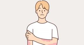 콜린성 두드러기 증상이 주목된다. 사진은 기사 내용과는 무관함. /사진=클립아트코리아