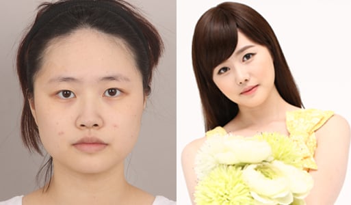 사진제공=뷰성형외과
