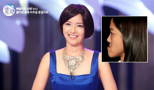 활짝웃는 최지혜씨(제공=뷰성형외과)