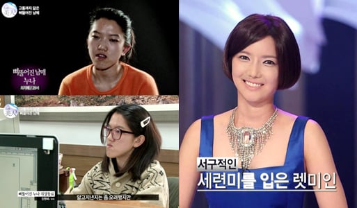 이미지제공=뷰성형외과