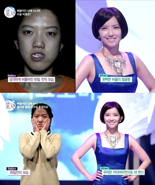 비뚤어진 남매, 최지혜