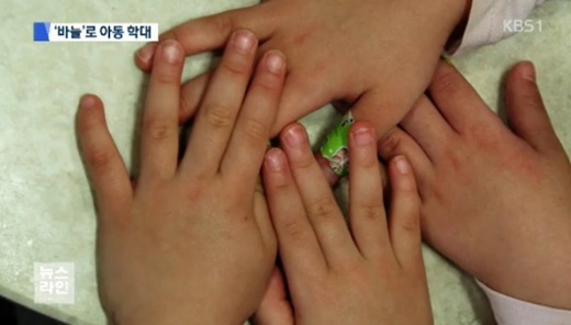 '어린이집 바늘학대' /KBS1뉴스 캡처