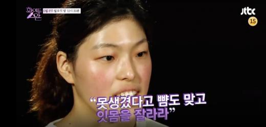 꿈은 사치? ‘화이트스완’두번째 주인공 설보경,주걱턱+부정교합 완벽 극복