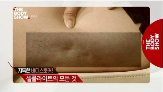 더바디쇼, 셀룰라이트에도 계급이 있다…계급법 대처법도 밝혀져