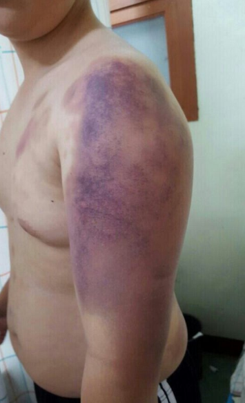 '대학생 집단폭행' 사진은 폭행당한 대학생. /사진=뉴시스