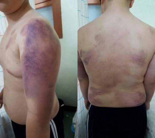 경북 경산의 한 대학교 기숙사에서 동급생으로부터 구타당한 피해자 모습 /사진=네이트판 