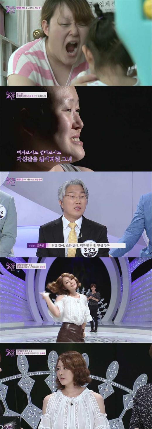 '화이트스완' 싱글맘 양혜원, 성형에 다이어트 거치니…“헉, 동일인물 맞아?”