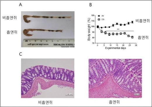 흡연 크론병. /사진=한국연구재단 제공