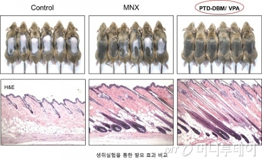 탈모. /사진=과학기술정보통신부 제공