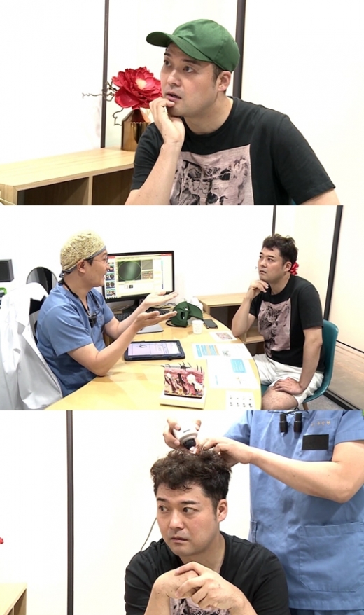 전현무 탈모. /사진=mbc 제공