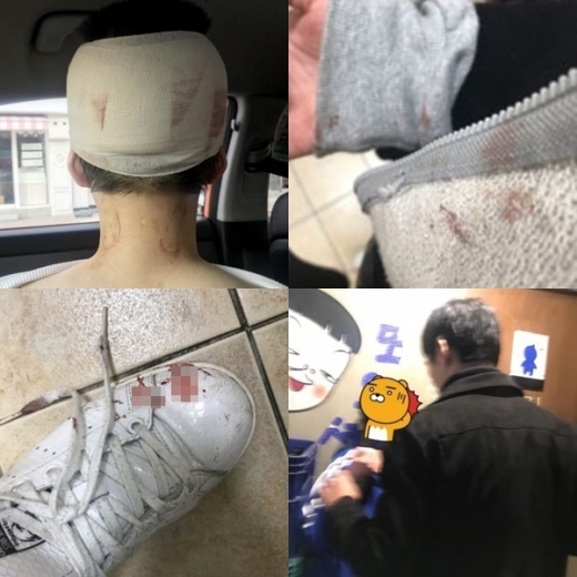 '이수역 폭행' 피해 여성이 공개한 상처부위와 현장 모습. /사진=온라인 커뮤니티 캡처
