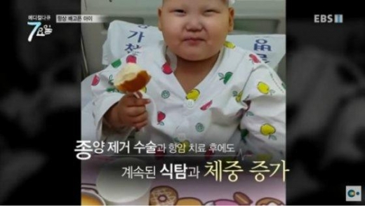 로하드 증후군을 앓고 있는 서현 양 ./사진=EBS 1T '메디컬다큐 ' 방송 캡처
