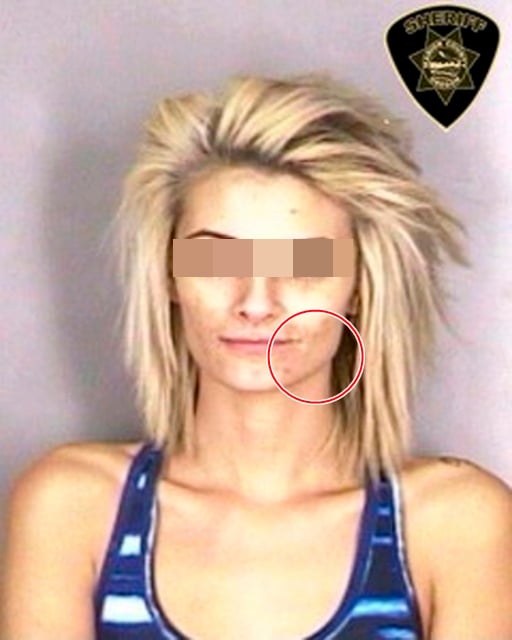 필로폰 복용자의 피부. /사진=로이터 