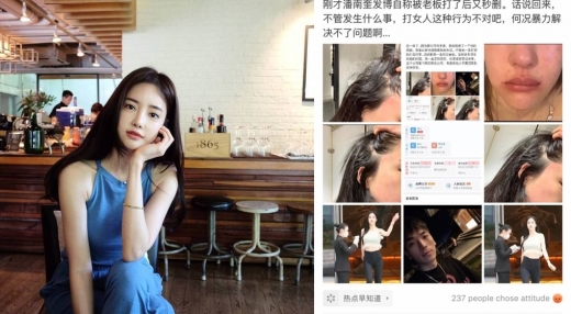 배우 반서진이 소속사 사장을 폭행 혐의로 고발했다. /사진=반서진 인스타그램 캡처   