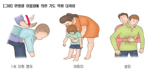 연령별 하임리히법./사진=서울아산병원