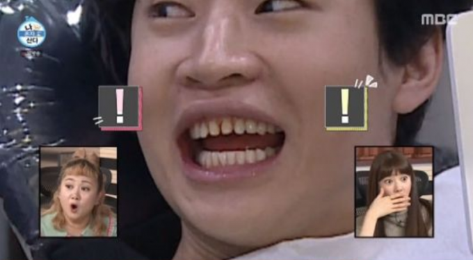 가수 헨리가 라미네이트를 떼어낸 치아를 공개했다. /사진=MBC '나혼자 산다' 캡처
