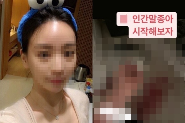 가수 박유천의 전 연인 황하나씨가 인스타그램을 통해 피투성이가 된 자신의 신체 일부를 공개해 충격을 안겼다. /사진=황하나 인스타그램