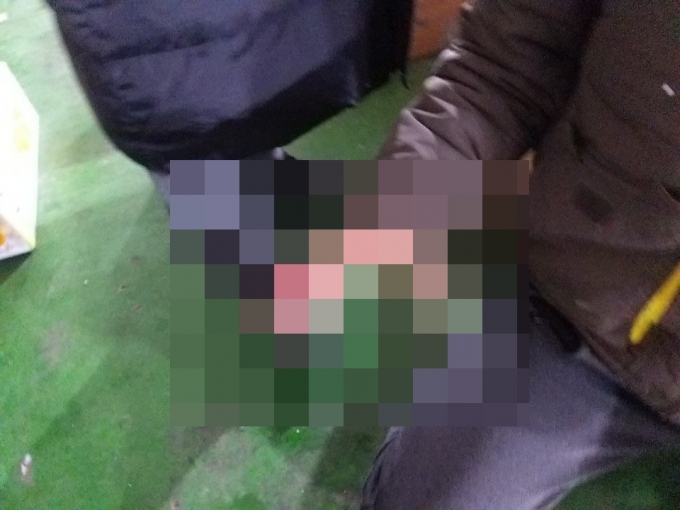 지난 22일 오전 5시30분쯤 로젠택배 부천지점 소속 택배기사 A씨(52·남)의 네 번째 손가락 위쪽이 절단됐다. /사진=전국택배노동조합 제공   