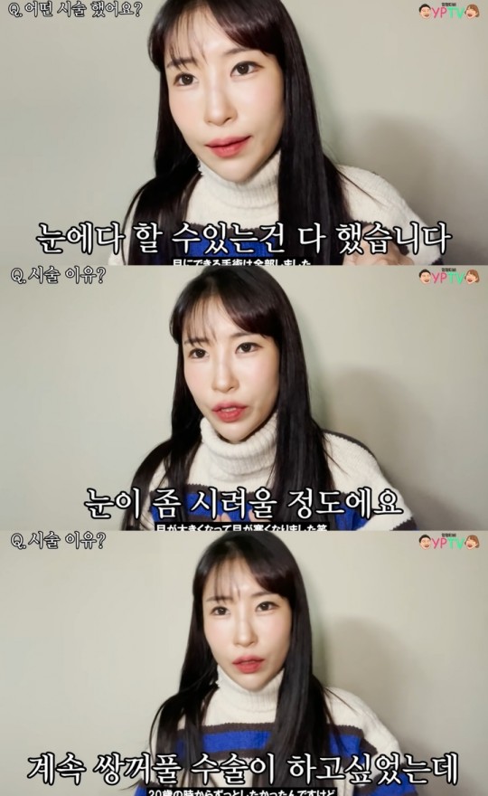 개그맨 이세영이 쌍커풀 수술 후 물오른 미모를 자랑했다. /사진=이세영 유튜브