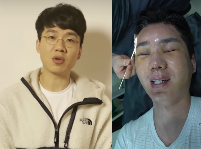 여성 혐오 논란으로 구설에 올랐던 유명 유튜버 보겸이 성형수술 후 얼굴을 공개하지 않겠다고 밝혔다. (유튜브 채널 '보겸TV' 갈무리) © 뉴스1