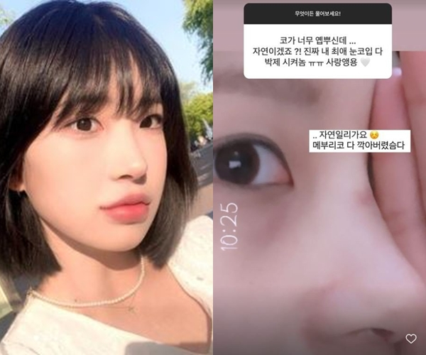 배우 고 최진실의 딸 최준희가 지난 26일 자신의 인스타그램을 통해 성형 사실을 고백했다./사진=최준희 인스타그램 캡처