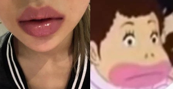 그룹 이달의소녀 멤버 이브가 흑인을 비하했다는 지적에 사과했다. 사진은 29일 이브가 팬들에게 공유한 입술 사진(왼쪽)과 '달려라 하니' 속 고은애 캐릭터. /사진=온라인 커뮤니티