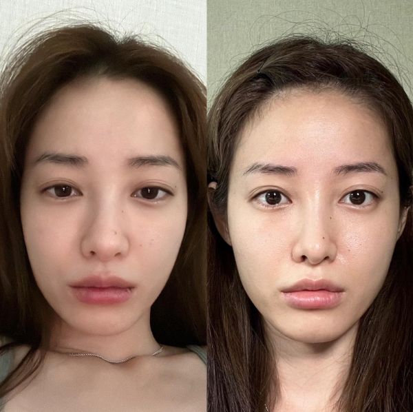 유튜버 유깻잎이 민낯으로 변화 전후 차이를 증명했다. /사진=유깻잎 인스타그램