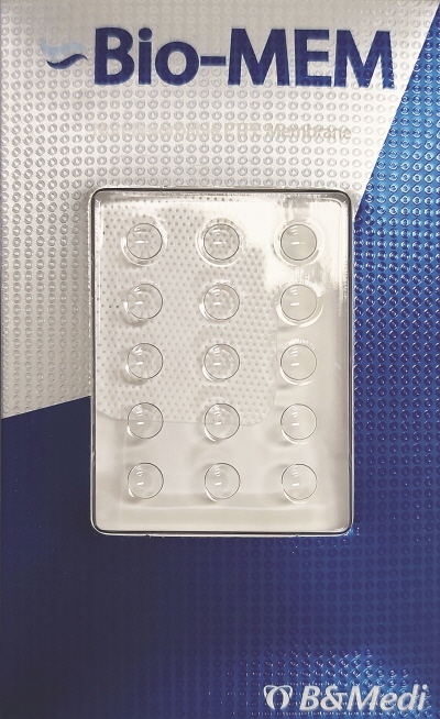 비앤메디의 치주조직 재생유도재 '바이오 멤'(Bio-MEM)이 미국 FDA(식품의약국) 501(K)인증을 통과했다. /사진=비앤메디