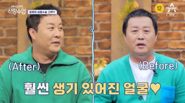 방송인 정준하가 시술 사실을 고백했다. /사진=채널A '요즘 남자 라이프-신랑수업'