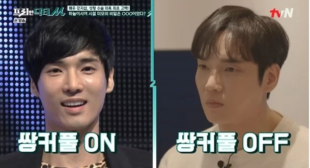 배우 강지섭이 성형수술 의혹을 고백했다. /사진=프리한 닥터M 방송캡처