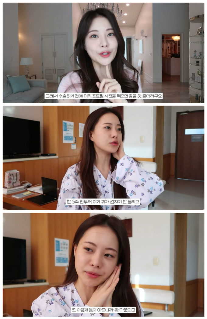 유튜버 아옳이가 진주종 수술 이후 회복하는 일상을 담은 영상을 게재했다. /사진=아옳이 유튜브 캡처