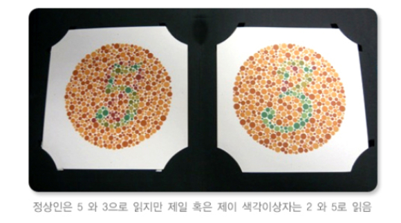 색을 완전히 구분하지 못하는 것을 색맹, 일부를 구분하지 못하는 것을 색약이라고 한다. 후천적으로 색각이상을 보이는 사람은 원인 질환을 치료하면 개선할 수 있기 때문에 갑자기 증상이 나타난다면 병원을 방문하는 것이 좋다. /사진=질병관리청