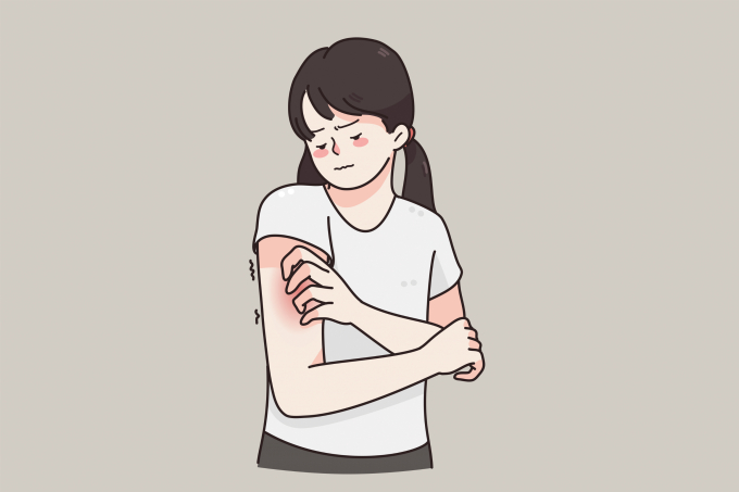 소아 아토피피부염 환자의 피부 상태를 악화시키는 원인균이 국내 연구팀에 의해 밝혀졌다. 사진은 기사와 직접적인 관련없음. /사진=이미지투데이