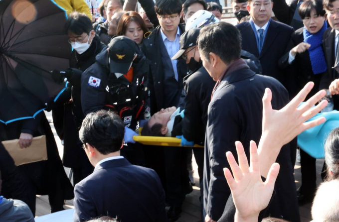 이재명 더불어민주당 대표가 피습 8일만인 10일에 퇴원할 예정이다. 사진은 지난 2일 오전 부산 강서구 대항전망대를 방문해 가덕신공항 건설 예정지를 둘러본 뒤 흉기 피습을 당해 병원으로 이송되고 있는 이재명 더불어민주당 대표. /사진= 뉴시스