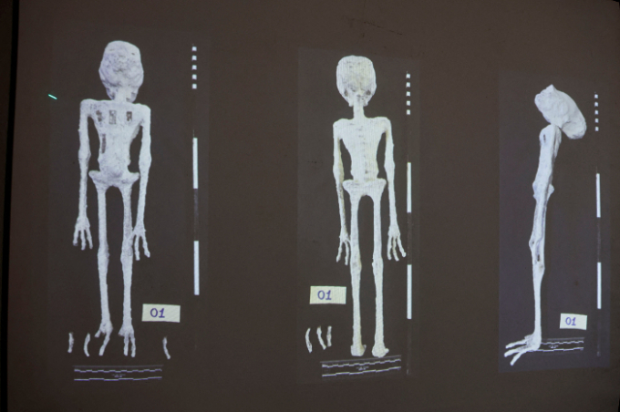 멕시코 의회 청문회에서 '외계 생명체의 시신'이라며 공개된 사람 모양의 미라가 사실은 사람의 뼈와 접착제를 사용해 만들어진 인형인 것으로 밝혀졌다. 사진은 해당 인형의 X선 모습. /사진=로이터