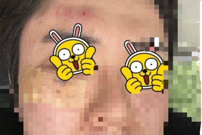 클락션을 울린 자동차의 앞길을 안비켰다고 집단폭행을 당한 일가족이 화제다./사진=뉴시스