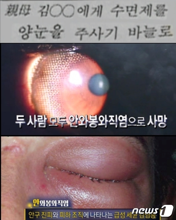 엄인숙은 수면제가 든 주사기로 친어머니 눈을 찔러 실명시키는 가 하면 두명의 남편도 눈을 찔러 실명에 이르게 한 후 그 후유증 등으로 결국 숨지케 했다. (SBS 갈무리) ⓒ 뉴스1