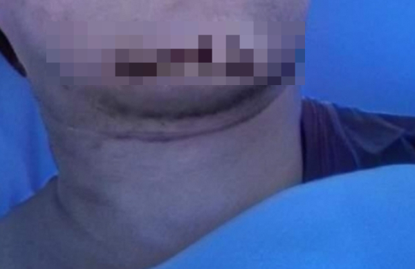 캄보디아에서 뺑소니를 당한 여행자가 여권을 빼앗길 위기에 처했다. 사진은 사고를 당한 한국 여행객의 모습. /사진=온라인 커뮤니티 캡처