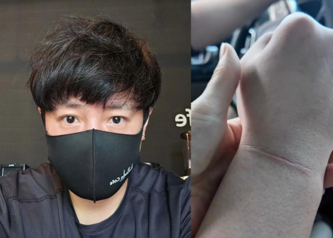 그룹 NRG 노유민이 아찔했던 사고 당시를 떠올렸다. /사진=이명천씨 인스타그램