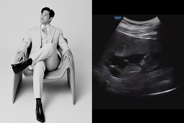 가수 나윤권이 아내의 임신 소식을 전했다. /사진=나윤권 인스타그램