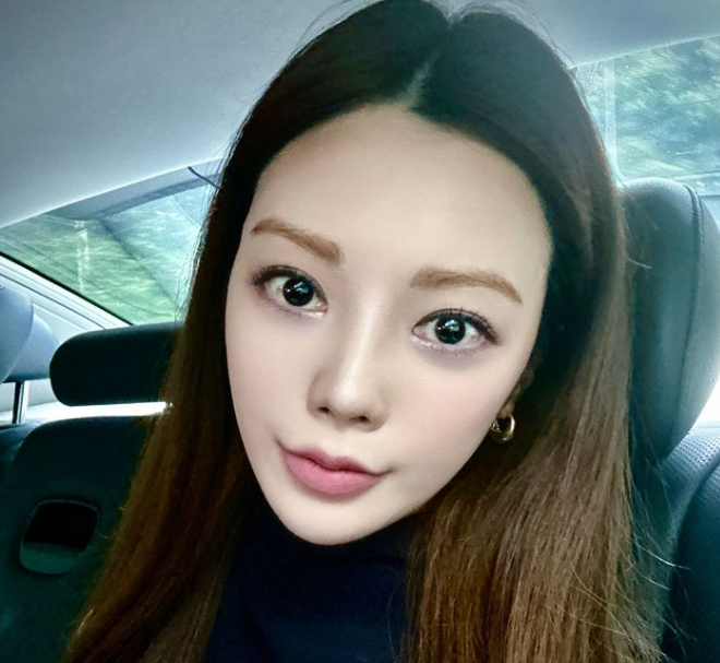 '음주운전' 리지, 자숙 중 달라진 얼굴… 성형설 '논란'