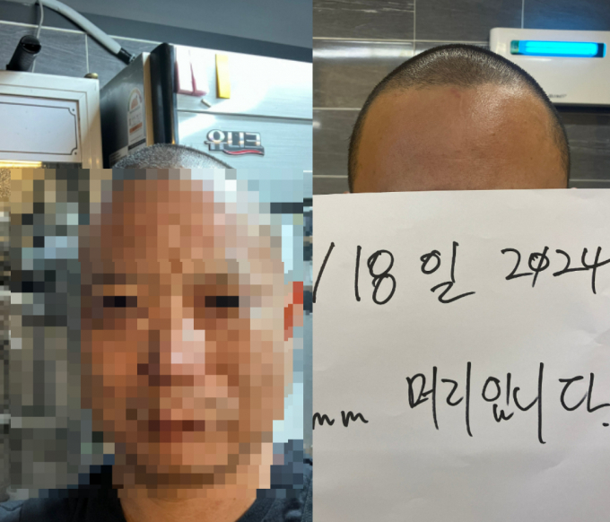 손님이 음식에 머리카락이 나왔다며 환불을 요구하자 머리카락 길이를 인증한 업주의 사연이 전해졌다. 사진은 업주가 올린 셀카. /사진=온라인 커뮤니티 '아프니까 사장이다' 갈무리 