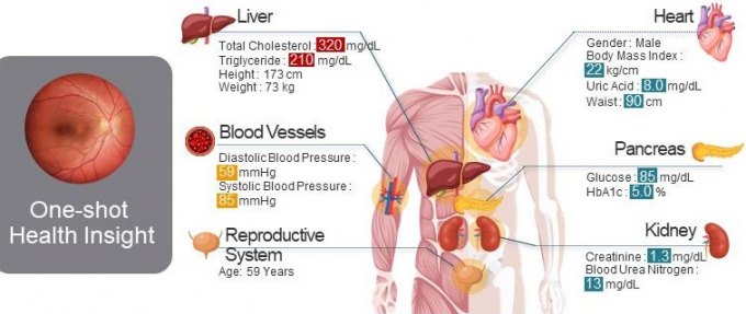 경기도가 지원하는 성균관대 ICT명품인재양성사업단이 안저영상 데이터로 안질환과 신체정보를 진단, 측정할 수 있는 기술을 확보했다. 사진제공=경기도 