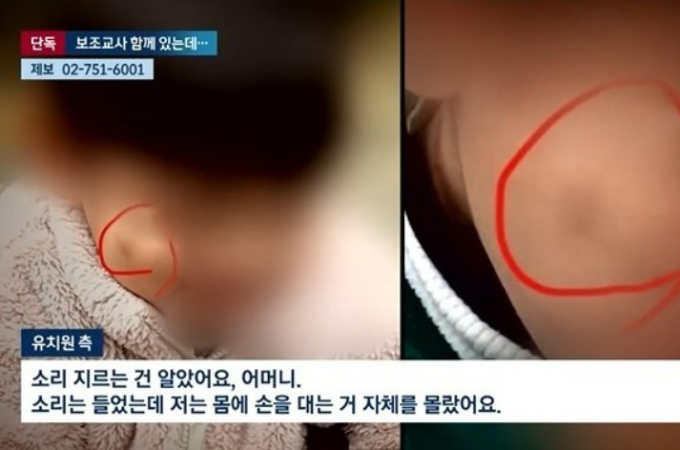 경찰이  6세 아이들의 목을 조르며 장기간 폭행한 유치원 교사에 대한 수사를 착수했다. /사진=JTBC뉴스 캡쳐