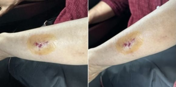부산의 한 버스 안에서 20대 여성이 아이의 팔이 닿았다는 이유로 3세 아이와 60대 할머니를 무차별 폭행한 사연이 온라인 상에서 전해졌다. /사진=온라인 커뮤니티 갈무리