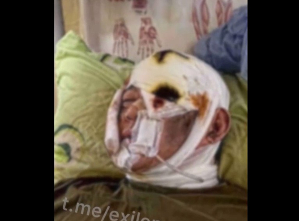 우크라이나와 교전 중 유일하게 살아남은 북한군으로 추정되는 영상이 텔레그램에 공개됐다. 사진은 해당 남성의 모습으로 부상 상태가 심각해 보인다. /사진=텔레그램 캡처