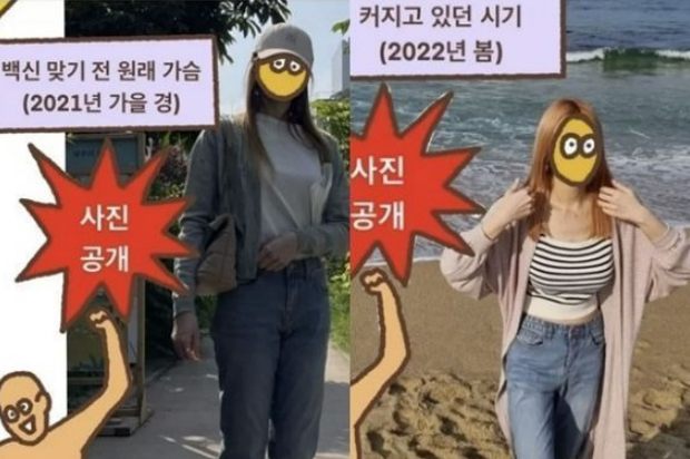 코로나19 백신 접종 후 가슴이 비정상적으로 커지는 유방 비대증 부작용을 겪은 사례가 국내외에서 잇따라 전해지고 있다. /사진= 네이버 웹툰 '어느 날 갑자기 가슴이 커짐' 캡처